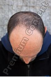 Head Hair Man Casual Slim Bald Street photo references